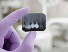 Dental Imaging