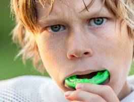 Mouth Guards