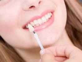 Perth Teeth Whitening