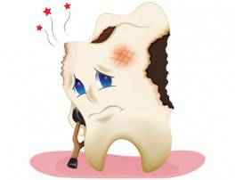 Tooth Extractions