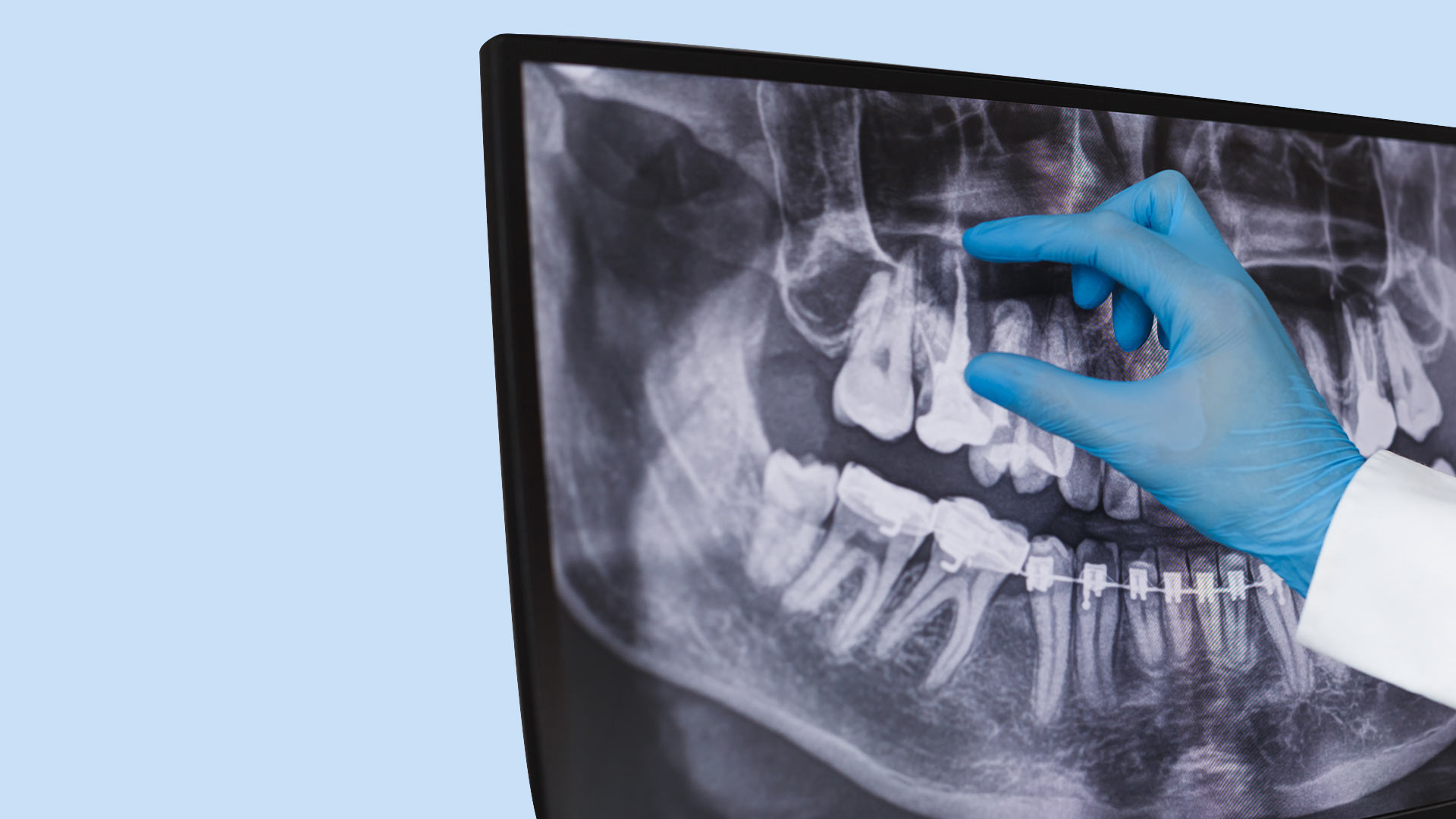 dentist examining dental x-ray of patient, private health service