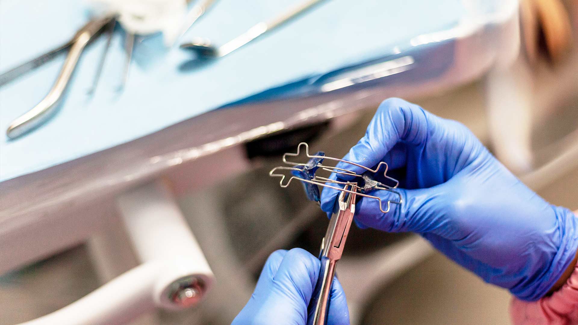 Mandibular Advancement Splint for Obstructive Sleep Apnoea