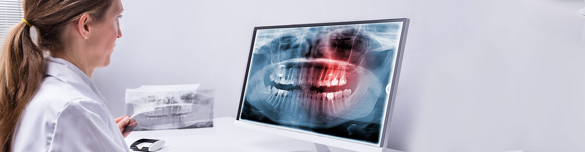 Wisdom Teeth Removal Perth Genesis Dental