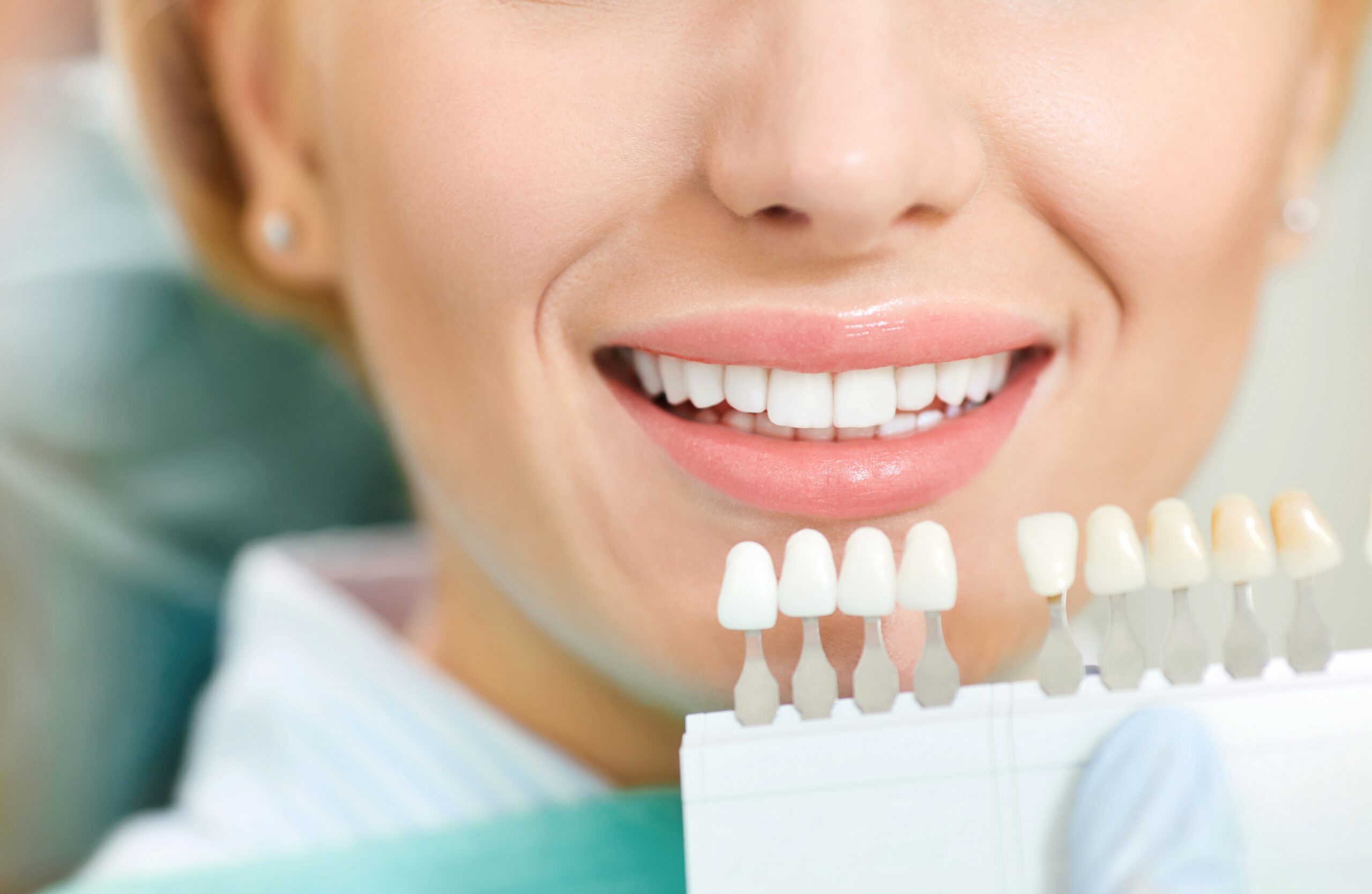 Teeth whitening dental clinic. Dentist selects the shade of the teeth to the patient waman with whitening samples.