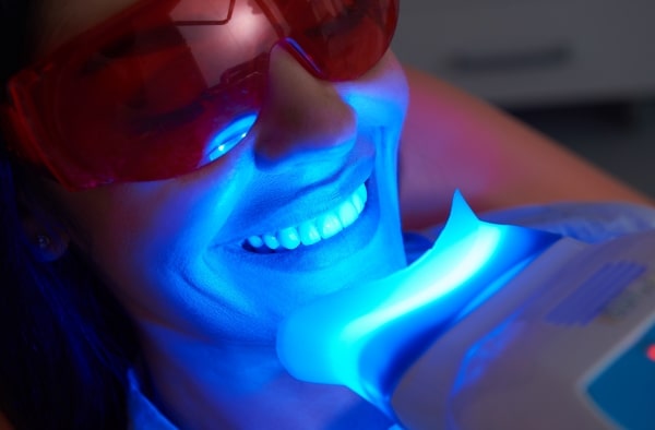 Teeth whitening is one of the most popular cosmetic dentistry treatments offering a quick, non-invasive and affordable way to enhance a smile.