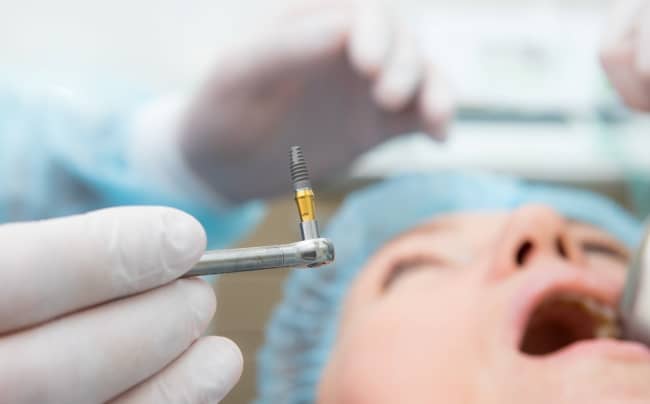 The type of implant treatment you choose will depend on your oral health, lifestyle and budget.