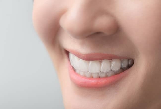 Clear aligners are lightweight and are nearly invisible when worn.
