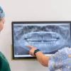 Two Genesis Dental dentists looking at an x-ray of wisdom teeth