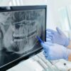 Dentist pointing at dental xray discussing safety tips