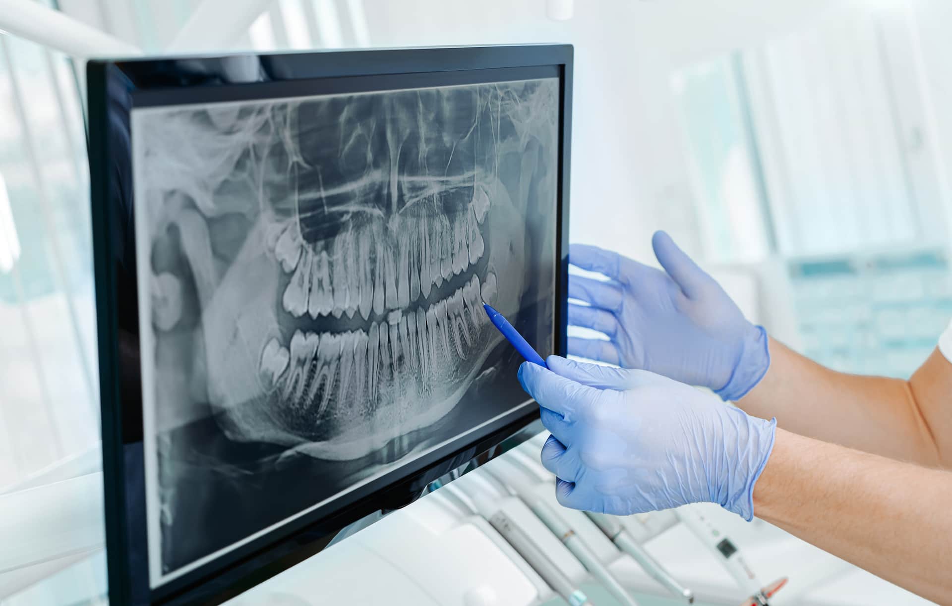 Dentist pointing at dental xray discussing safety tips